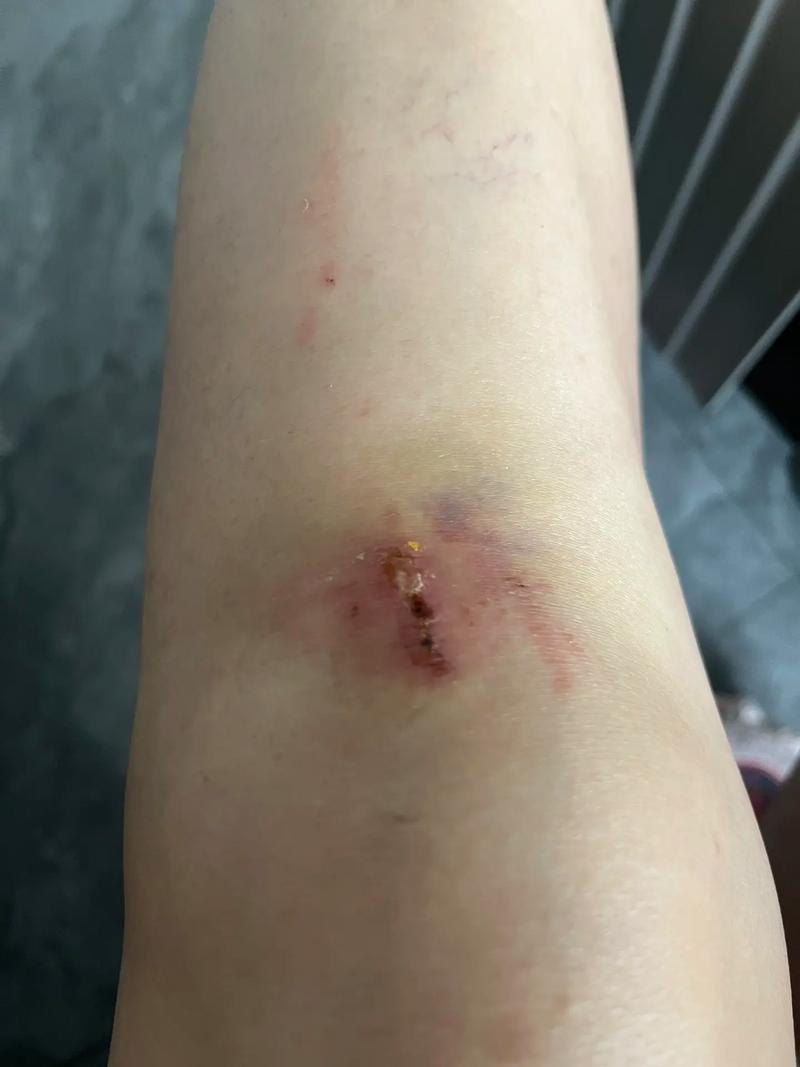 膝盖不好出行注意事项,膝盖不好出行注意事项有哪些-第1张图片-微云百科 膝盖不好出行注意事项,膝盖不好出行注意事项有哪些-第1张图片-微云百科