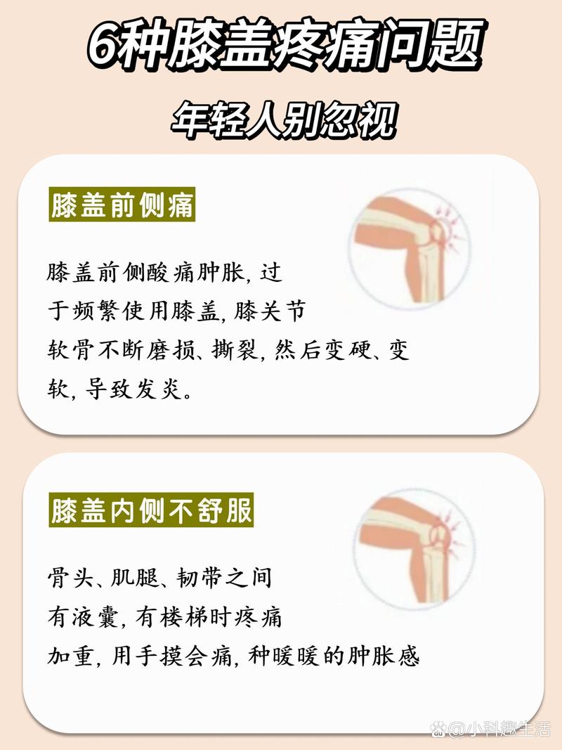 膝盖不好出行注意事项,膝盖不好出行注意事项有哪些-第4张图片-微云百科 膝盖不好出行注意事项,膝盖不好出行注意事项有哪些-第4张图片-微云百科